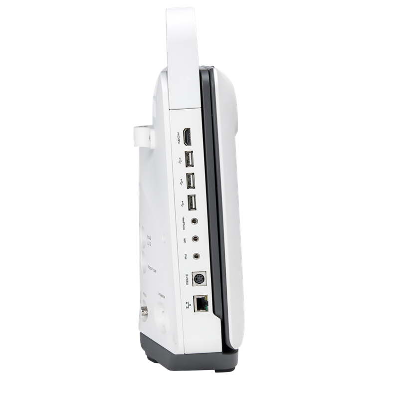 New advanced Sonoscape ultrasound E1 EXP 2D Portable Color Portable Human Ultrasound Machine with Long-lasting Battery