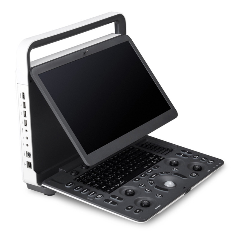 New advanced Sonoscape ultrasound E1 EXP 2D Portable Color Portable Human Ultrasound Machine with Long-lasting Battery