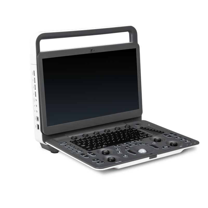 New advanced Sonoscape ultrasound E1 EXP 2D Portable Color Portable Human Ultrasound Machine with Long-lasting Battery