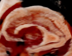 Congratulate! Ultrasound technology applied to fetal brain for the first time