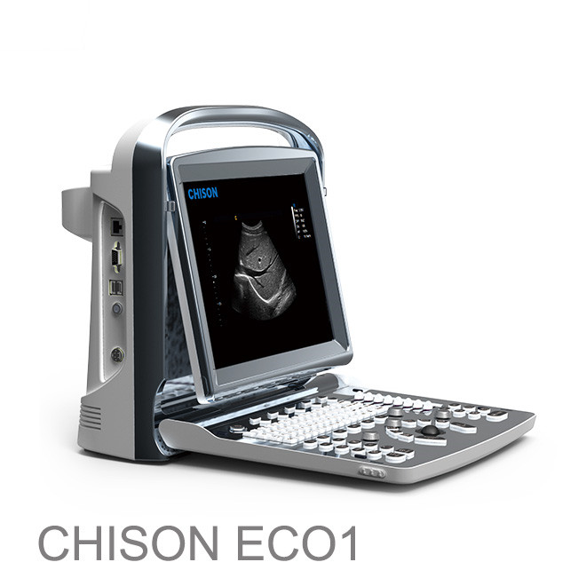 Ultrasonido (ecografo) abdominale ôfbylding: chison eco 1 goedkard FDA