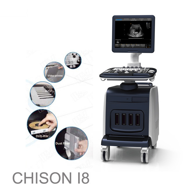 ultrazvočni abdominalni chison i8: porodniški ultrazvočni 4d doppler