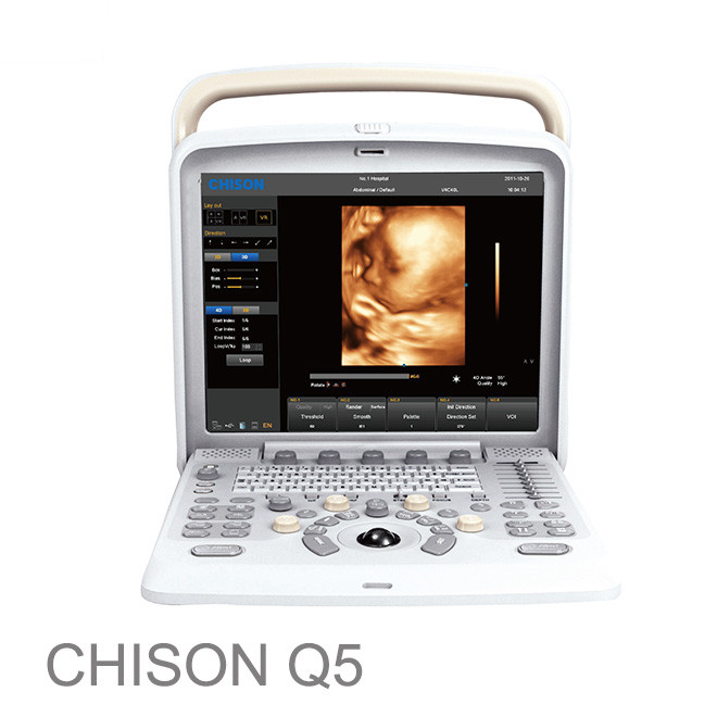 ultrasonido portatil 4d dopplerovský porodnický chison q5