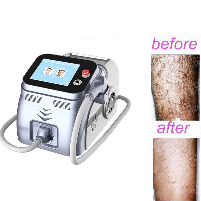 Best permanent painless facial ipl hair removal AMDL08 cost