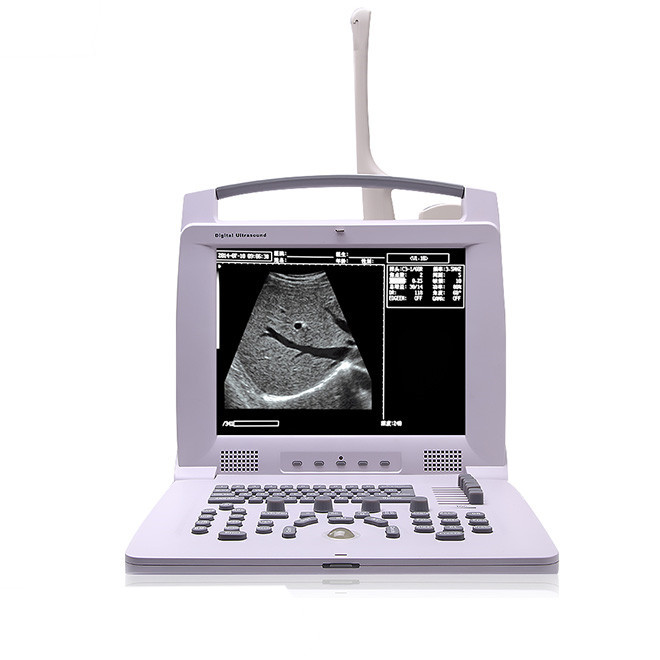 AMPU49 Full Digital Portable Ultrasound Scanner