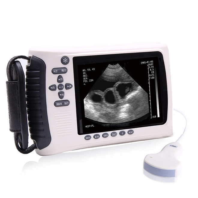 AMVU22 Veterinary Handheld Ultrasound Scanner