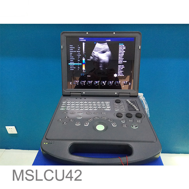 color doppler ultrasound in pregnancy