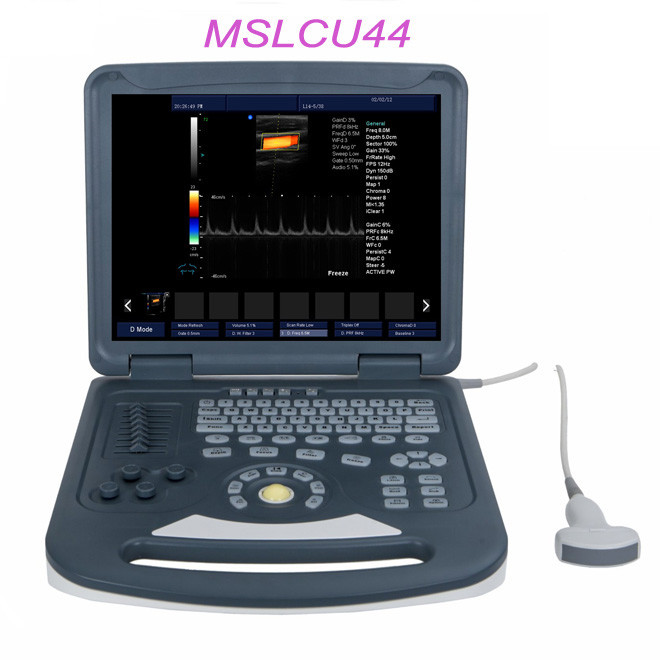 Notebook 2D Color Doppler Ultrasound System AMCU44