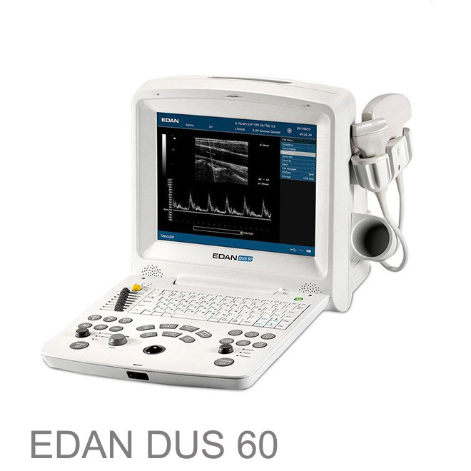 Clinic usg machine EDAN DUS 60 portable echo ultrasound