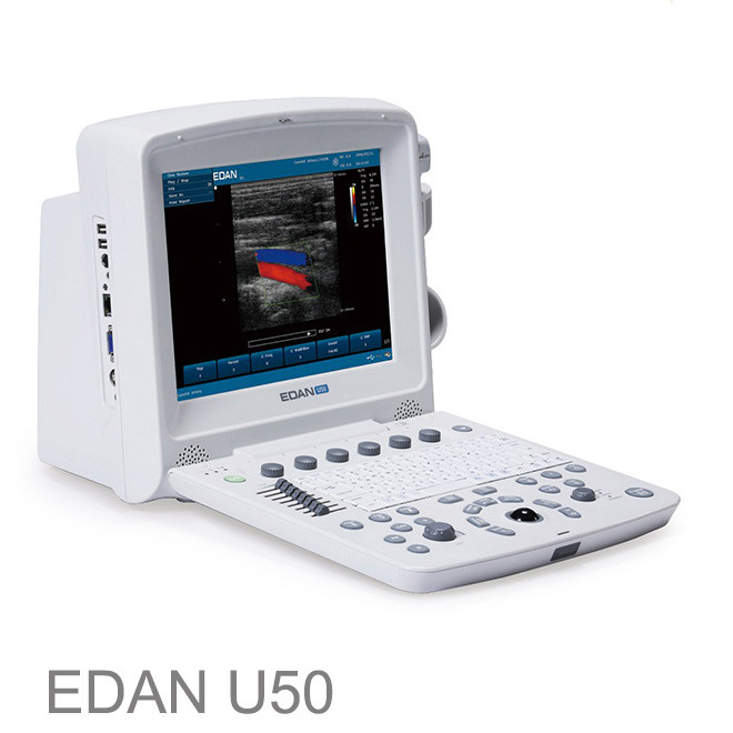 FDA approved colour doppler ultrasound pregnancy EDAN U50