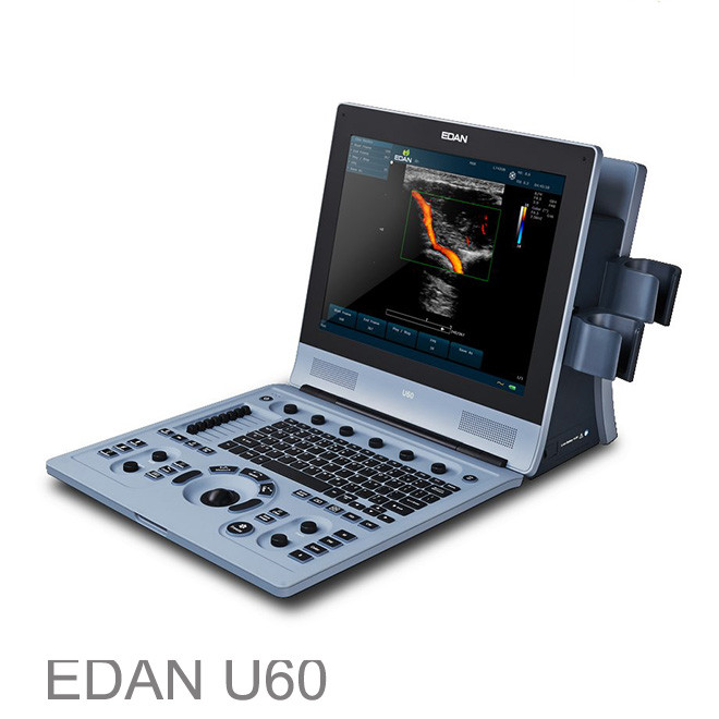 Edan U60 dyagnostik sistèm ultrason pri