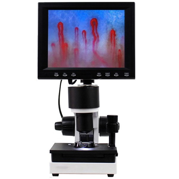 Màquina de prova de microcirculació sanguínia de plec d'ungles d'alta resolució AMXW01