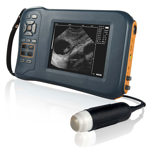 Professional And High Quality Ultrasound System Machine AMVU44