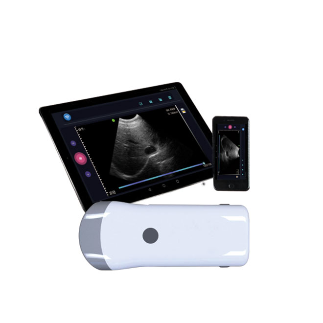 Wifi Portabel Ultrasound Scanner Mesin AMVU49 Pikeun diobral