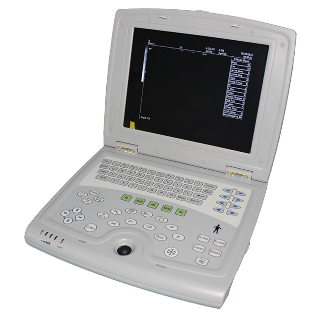 Full digital B mode ultrasond scanner machine AMDU07 for sale