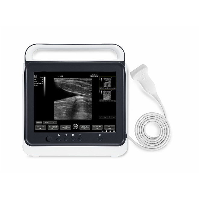 Portable touch screen vet ultrasound scanner machine AMVU40