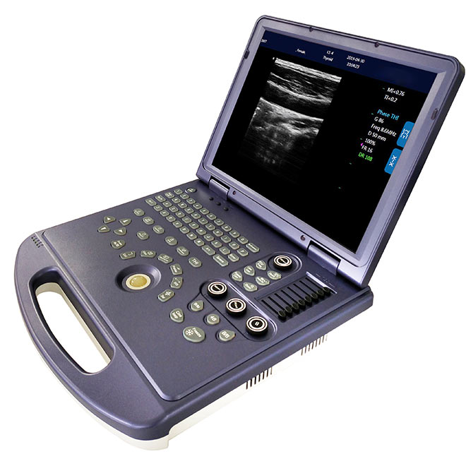 All-Digital B/W Diagnostic Medical Ultrasound Machine AMPU75