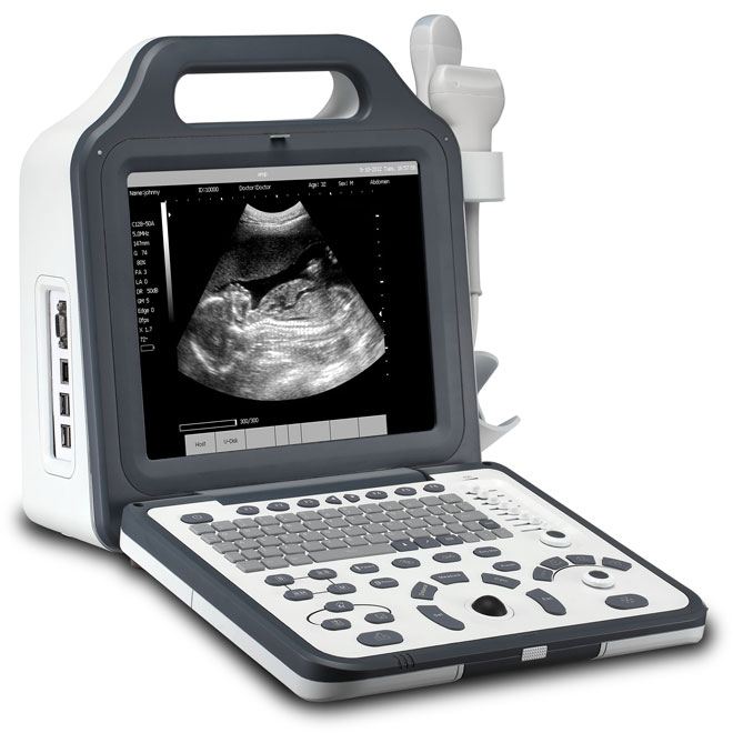 Ασύρματο Mini B&Color Doppler Ultrasound Scanner AMPU51 τιμή