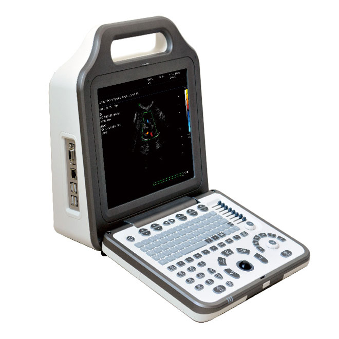 Makinat më të mira të ultrazërit Ultratinguj me ngjyra Doppler AMCU51