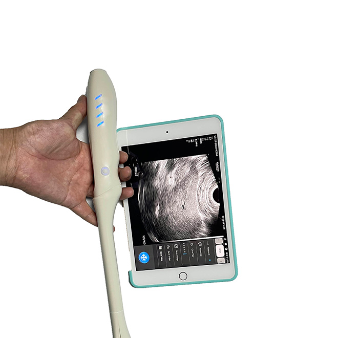 Wireless Transvaginal Color Doppler Ultrasound Probe AMAA120