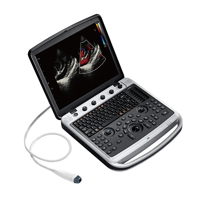 Eksepsyonèl sistèm ultrason Chison SonoBook8