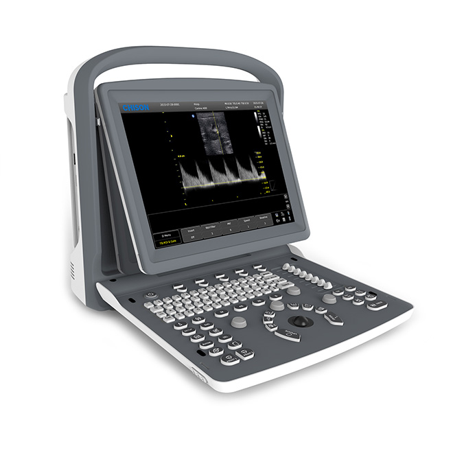 Premium konsepsyon ultrason machin Chison ECO2Vet