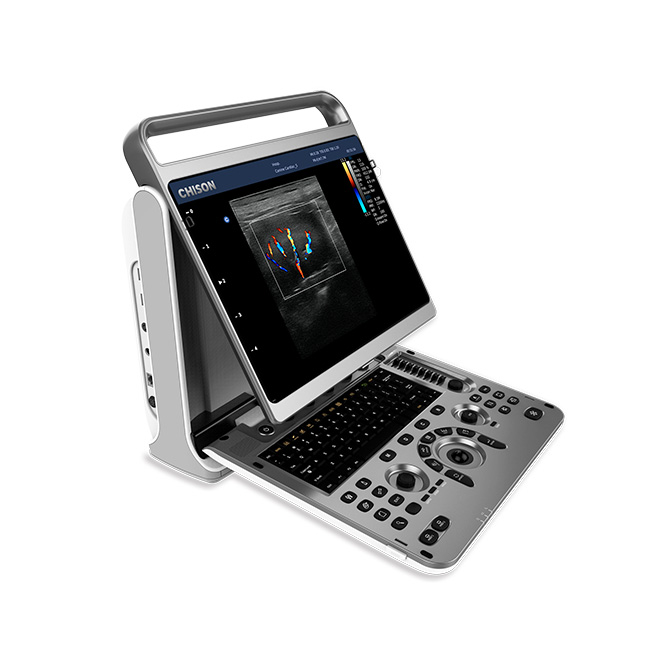 Functional Chison ultrasound machine EBit30