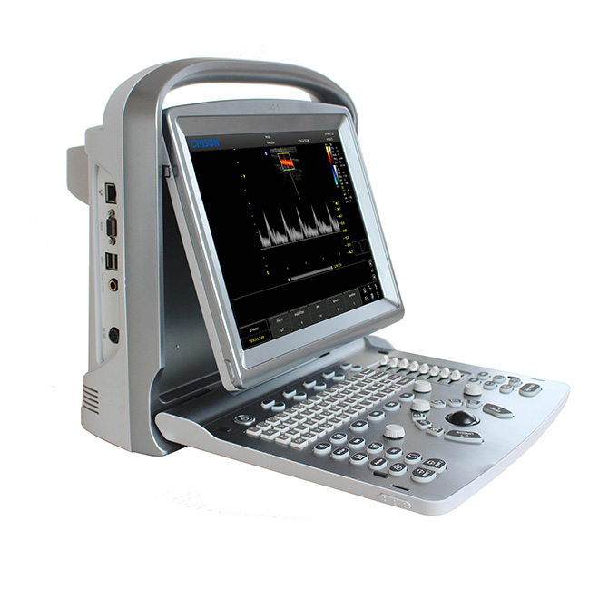 Natatanging Chison ultrasound machine ECO5