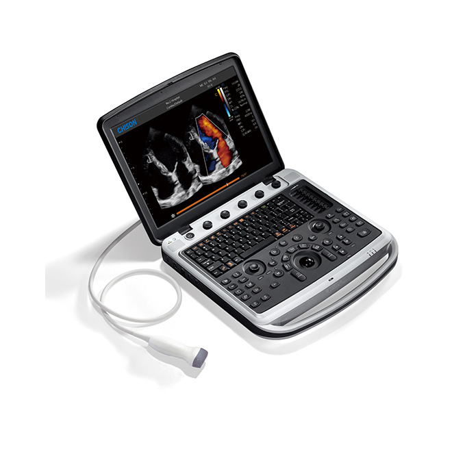 ម៉ាស៊ីន Ultrasound សមត្ថភាពពិសេស Chison SonoBook9