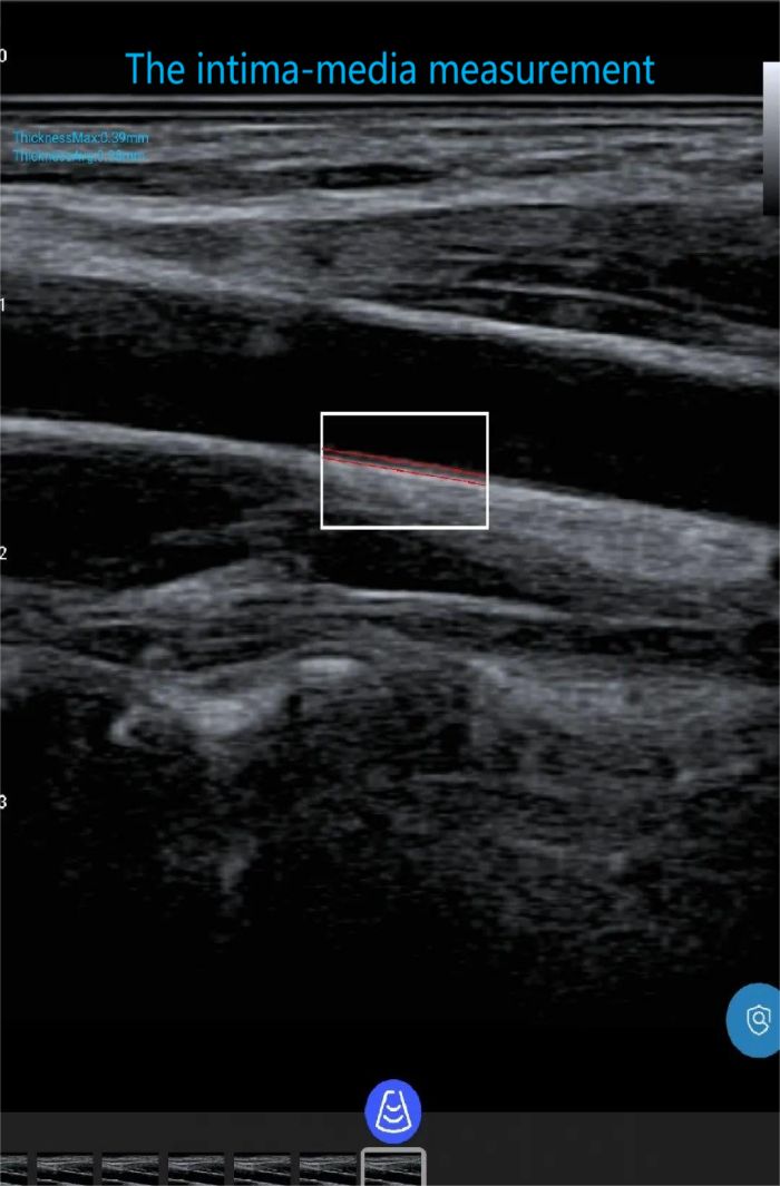 Amain MagiQ yonyamula m'manja Ultrasound4