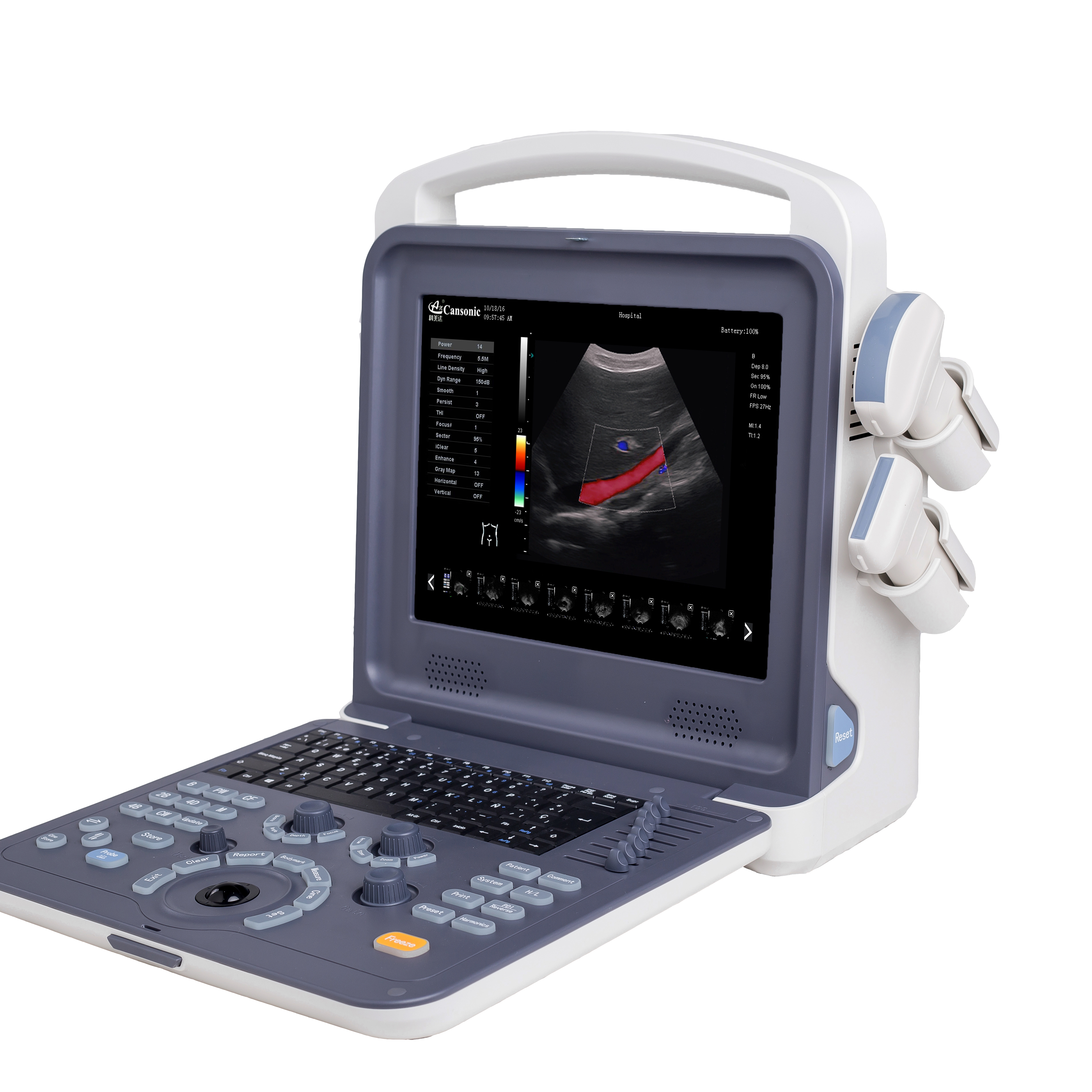 Pregnancy and Baby ultrasound machine AMAIN find C2