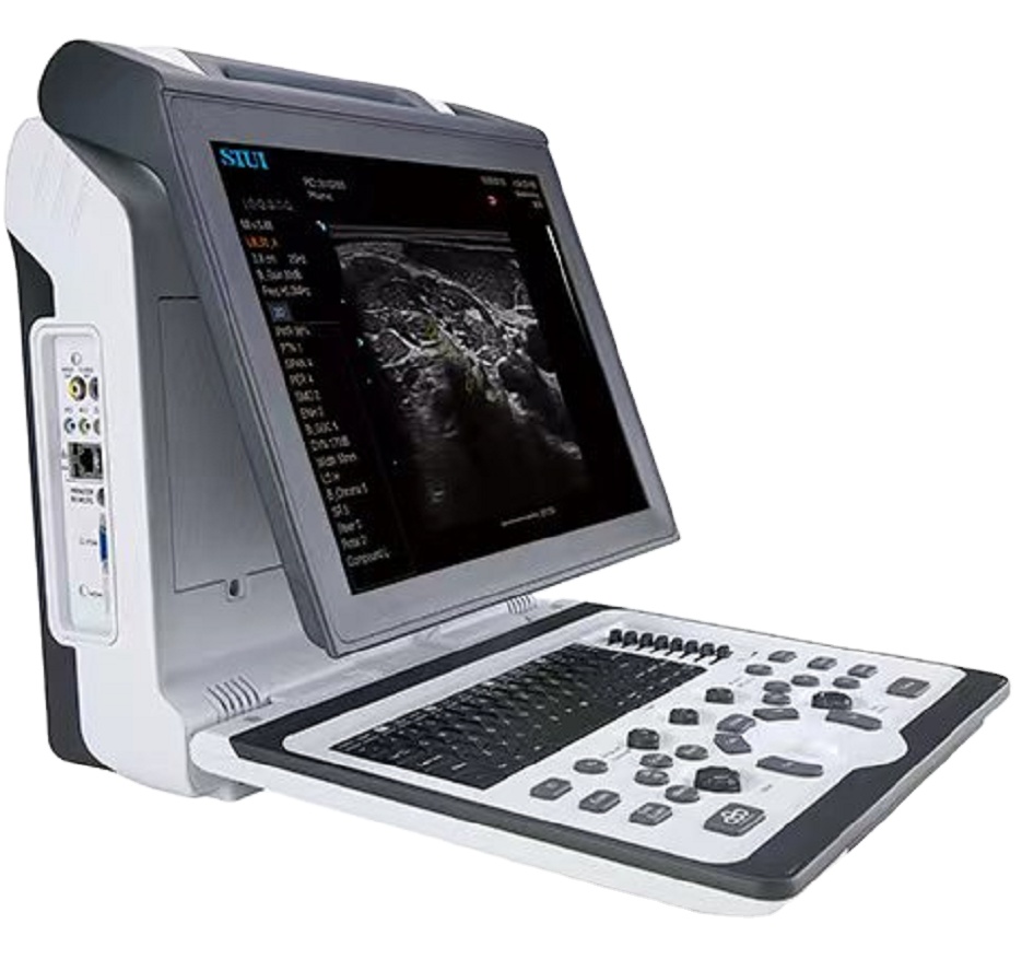 SIUI Apogee 2300 Ultrasound Laptop Color Doppler Portable Ultrasound Scanner with Ergonomic compact design