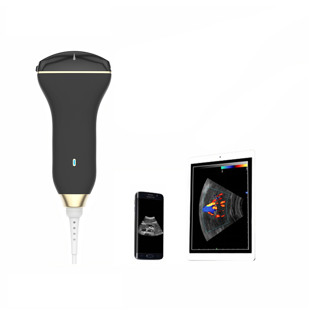 Amain MagiQ 3C Convex Handheld Medical sonoscape ultrasound machine