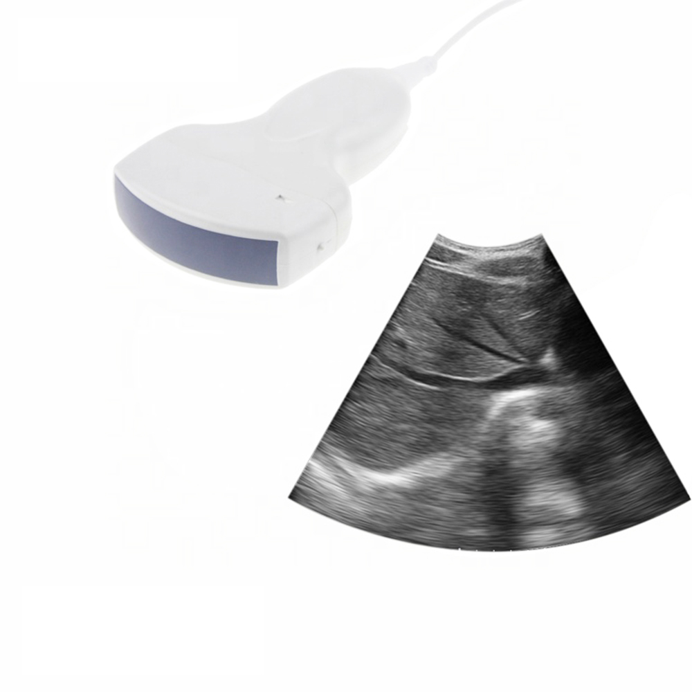AMAIN MagiQ 2L OEM ODM Supported Ultrasound Scanner