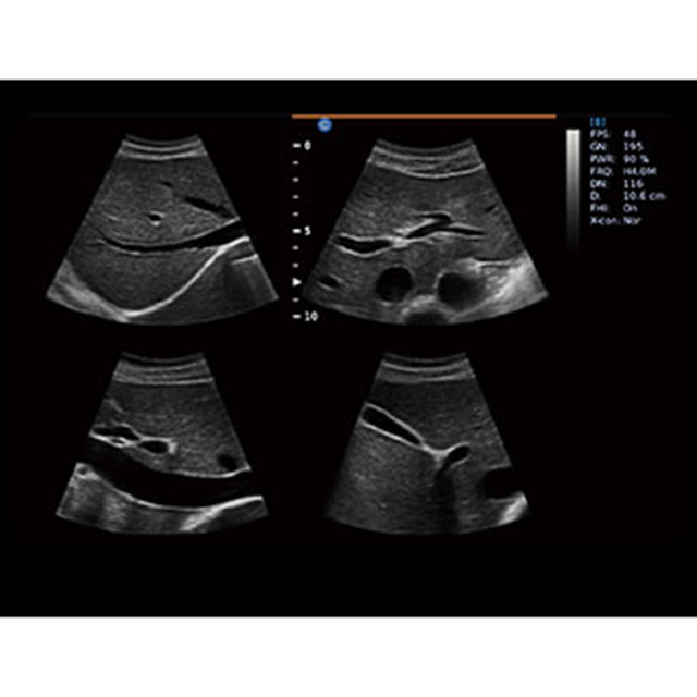 CHISON EBit 30 Medical Ultrasound Instruments with Optional Probes for Clinical Diagnosis