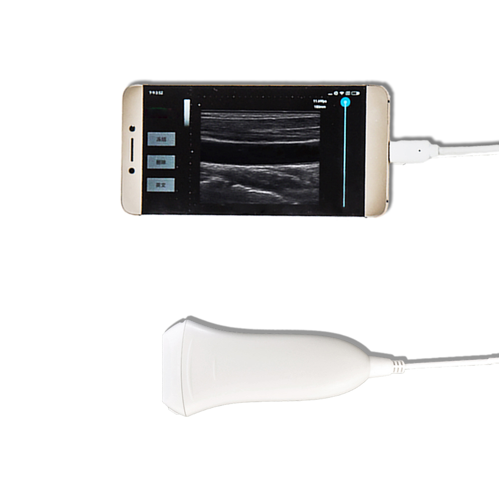 Amain MagiQ 2L HD Linear Sistem Ultrasound Medis Genggam