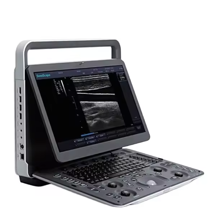 Sonoscape veterinary ultrasound machine e1v for vet color doppler animal portable ultrasound machine