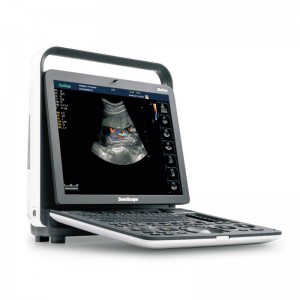 SonoScape S8 Exp Clinic Χρησιμοποιήστε φορητό υπερηχογράφο