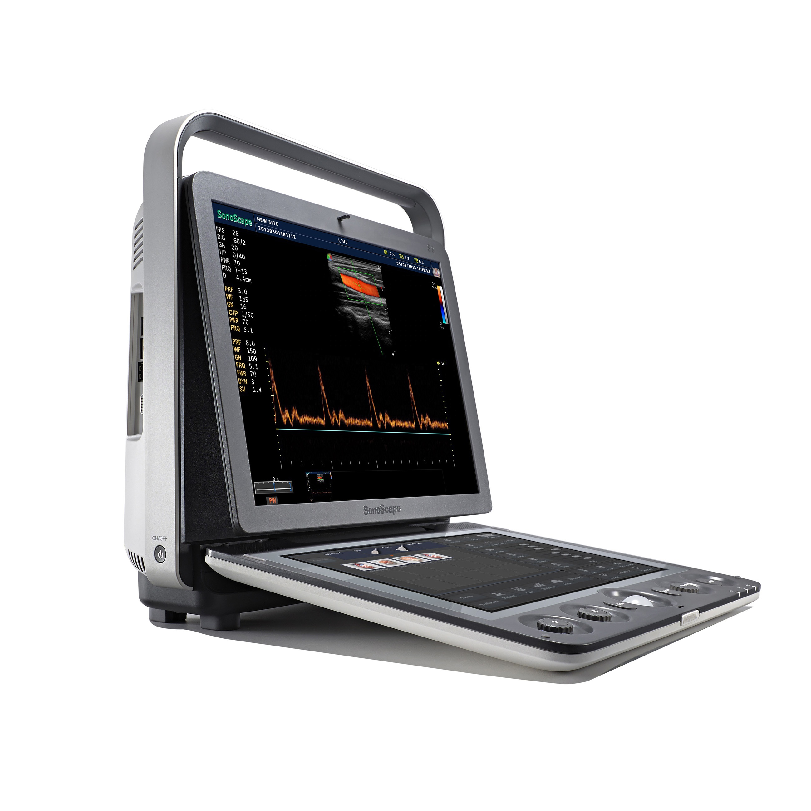 SonoScape S9 Affordable Veterinary Full Digital Portable Ultrasound Scanner With CE Certification