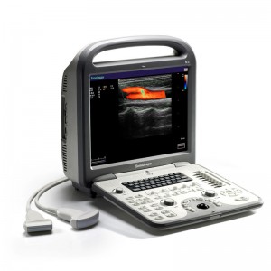 SonoScape S6 ya Moyo na Laptop ya Transvaginal Ultrasound