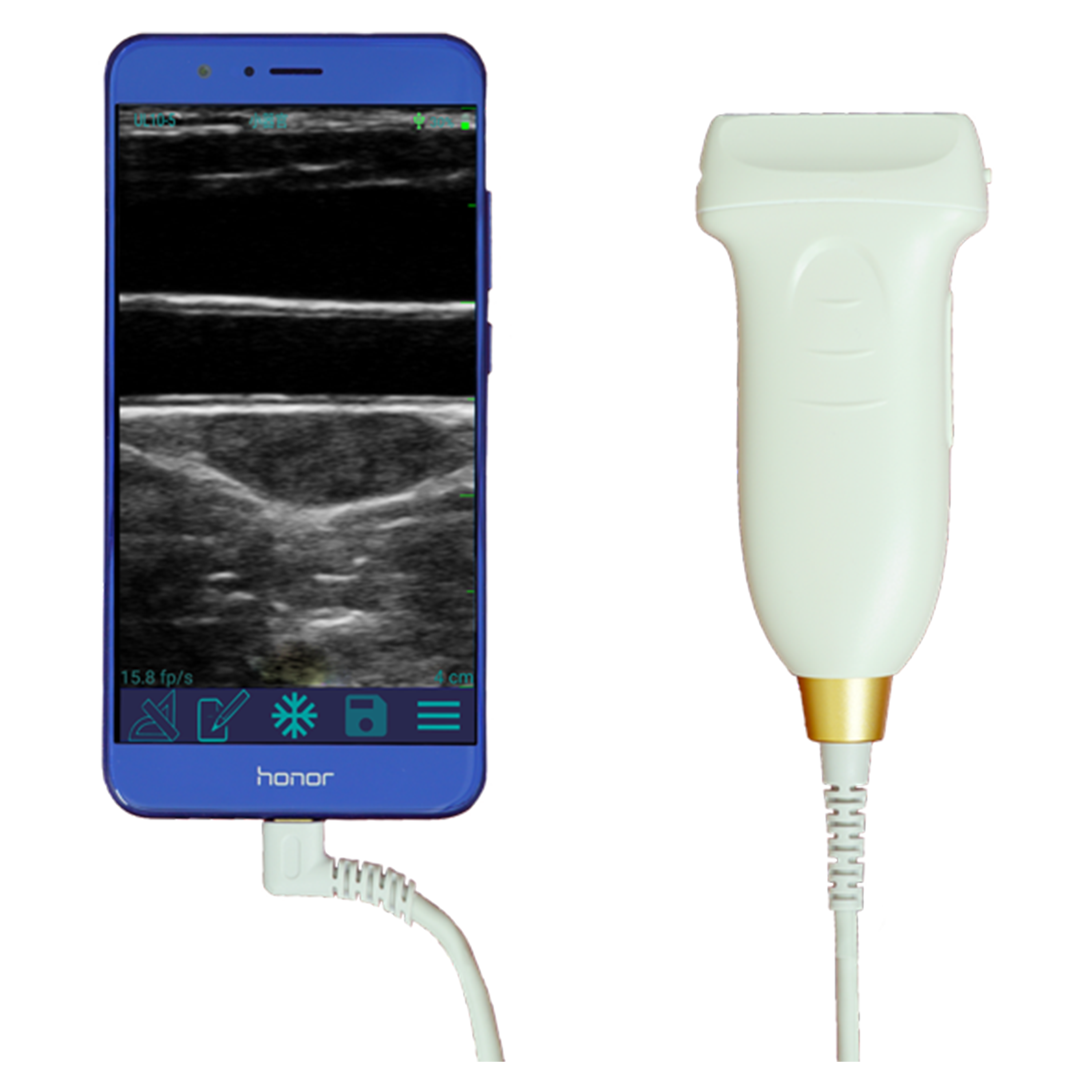 2022 China New Design Syringe Pump - Amain MagiQ MPUL10-5 Mini-sized Ultrasound Scanner  – Amain