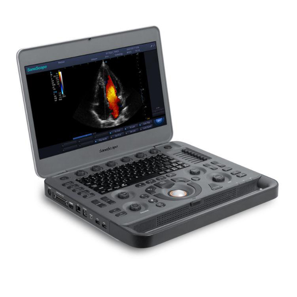 SonoScape X3 Ecograph Dizüstü bilgisayar 3D 4D Renkli Doppler Ultrason Hastane Teşhisi için Satışta