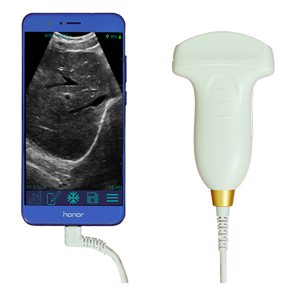 Amain MagiQ MPUC 5-2E Sistemas de escáner de ultrasóns para diagnóstico por imaxe médica convexa en branco e negro