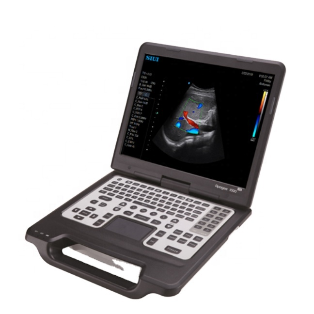 Apogee 1000 Lite Ultrasound Laptop System Portable Ultrasound Scanner Color Doppler Ultrasound Hot sales
