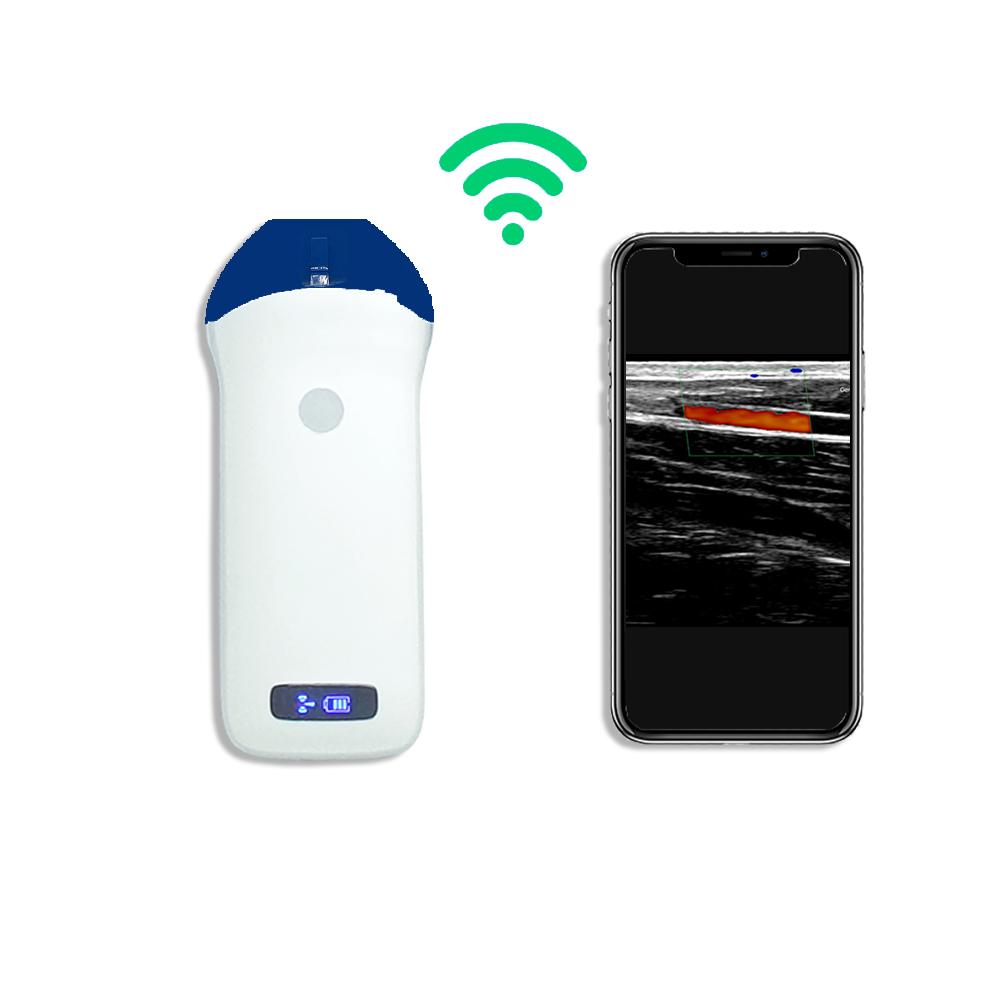 Amain MagiQ LW5PC Linear Color Doppler Puncture Guide Wireless Handheld Ultrasound Probe