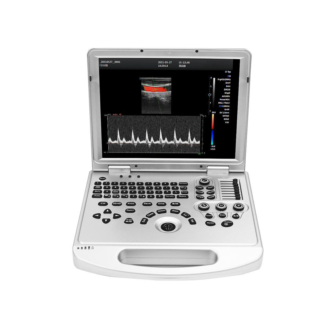 Amain OEM/ODM Manufacturers Basic AMDV- L5 Plus color doppler 3D ultrasonic medicine with full digital diagnostic system
