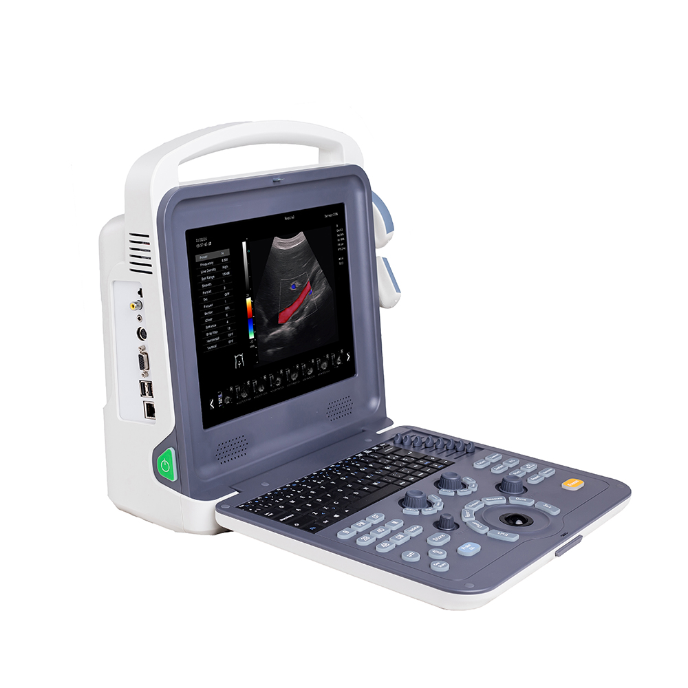 AMAIN Loaʻa C2 128 Element Gynecology Ultrasound Machine