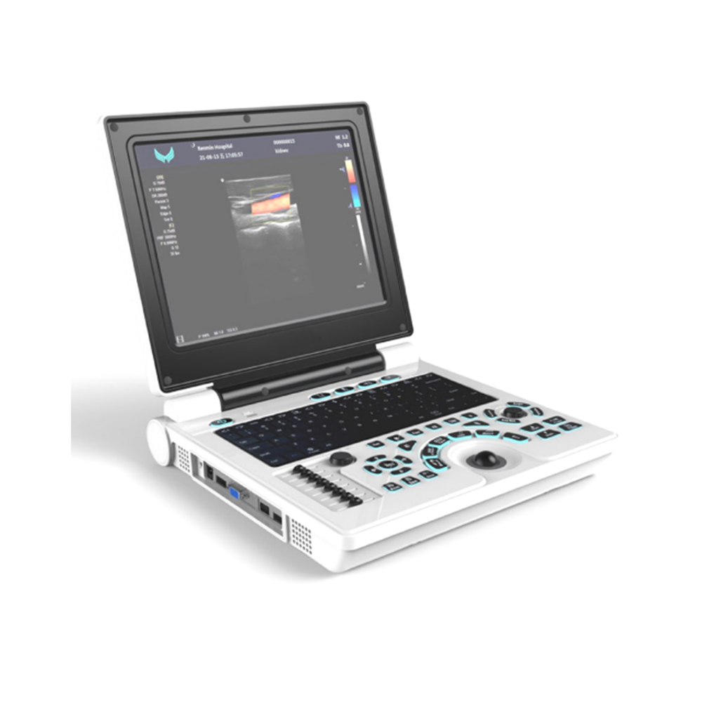 Sistema de diagnóstico ultrasónico Doppler color para portátil E20