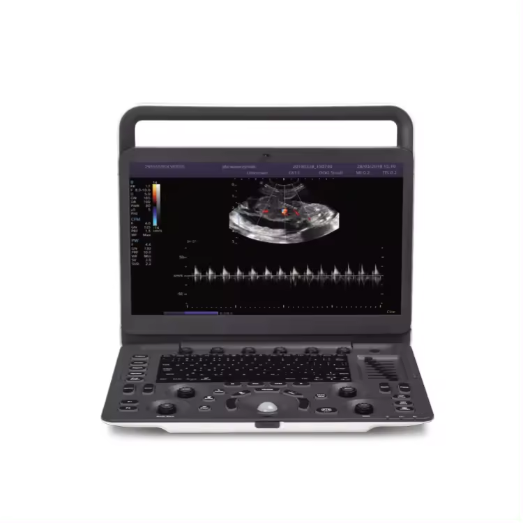 Sonoscape veterinary ultrasound machine e1v for vet color doppler animal portable ultrasound machine