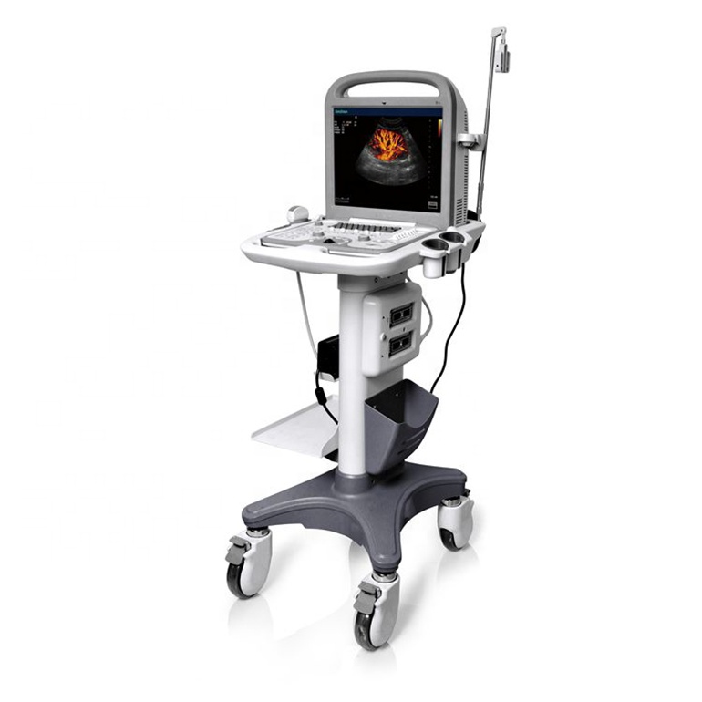 SonoScape S6 Cheap Cardiac and Transvaginal Application Laptop Ultrasound Machine With Advanced Technologies